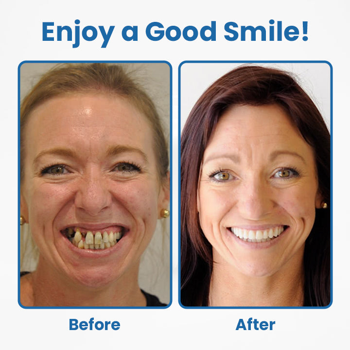 Ceoerty® RevitaDent Bee Venom Oral Treatment Powder