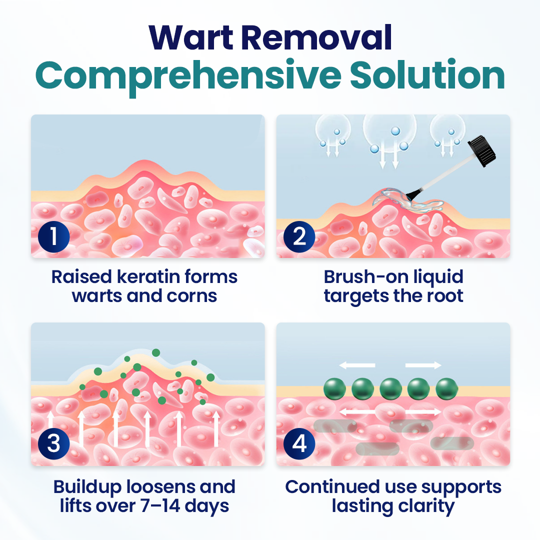 Timilk® WartLift Corn Removal Liquid 💝