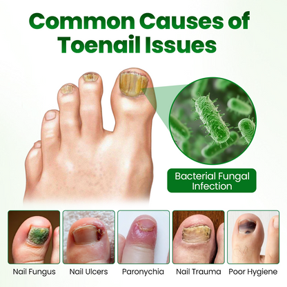 Timilk® HerbaNail 7-Day Repair Serum 🔥 FDA Certified (Clinically Proven Herbal Formula for 7-Day Nail Fungus Repair & Strength Restoration 🌿)