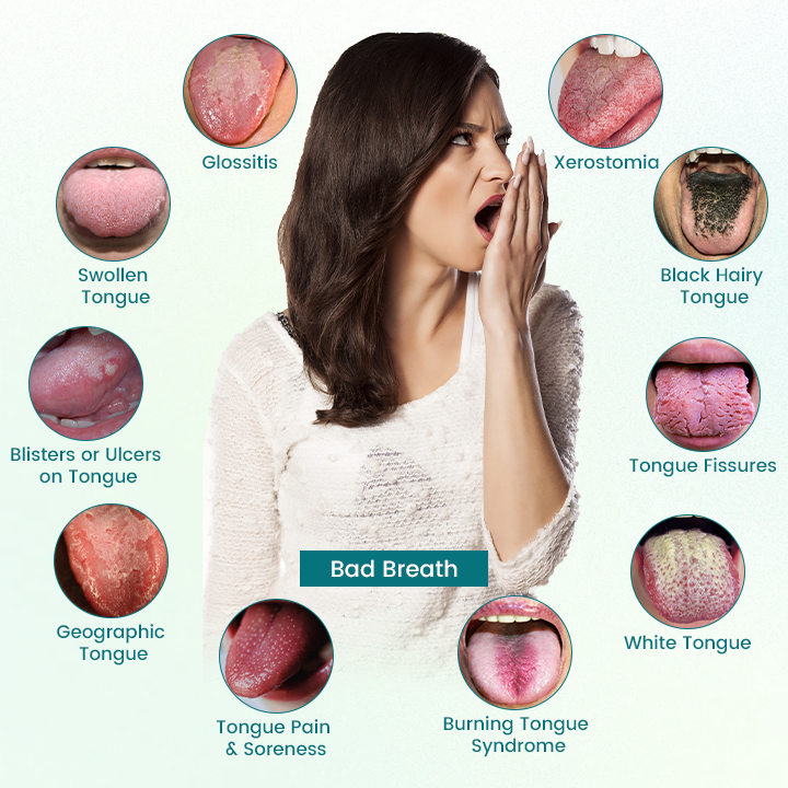 Timilk® GlosShield Tongue Repair Spray