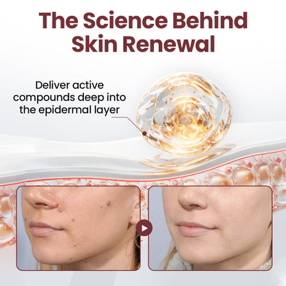 (New)Biancat® KeraErase Dual-Action Renewal Cream