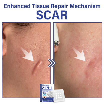 🔥Timilk® DermalRepair 2-in-1 Microneedle & Hydrocolloid Patch 💉| Raised Moles, Acne, Flat Warts & Skin Tags Remover | Improves Wrinkles, Scars & Blemishes | Invisible Pimple Patches for Face & Body💎