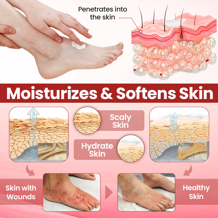 Timilk® VitaGluco Diabetic Care Cream