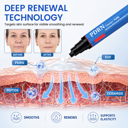 Ceoerty® PDRN Aurevixa Advanced Renewal Cream