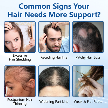 Ceoerty® RootVive Hair Growth Serum Roll-On