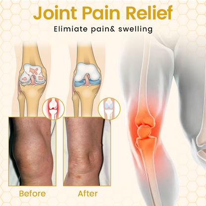 Timilk® VenomFlex Bee Therapy Cream