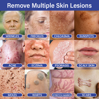 🔥Timilk® DermalRepair 2-in-1 Microneedle & Hydrocolloid Patch 💉| Raised Moles, Acne, Flat Warts & Skin Tags Remover | Improves Wrinkles, Scars & Blemishes | Invisible Pimple Patches for Face & Body💎