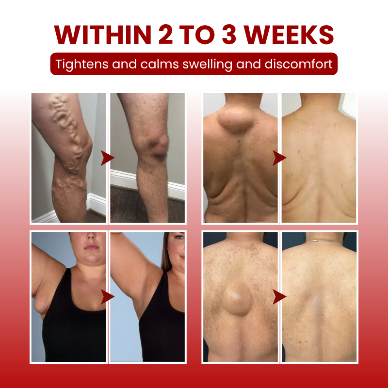 Timilk® SwellCare Professional Lymphatic Drainage Massage Cream