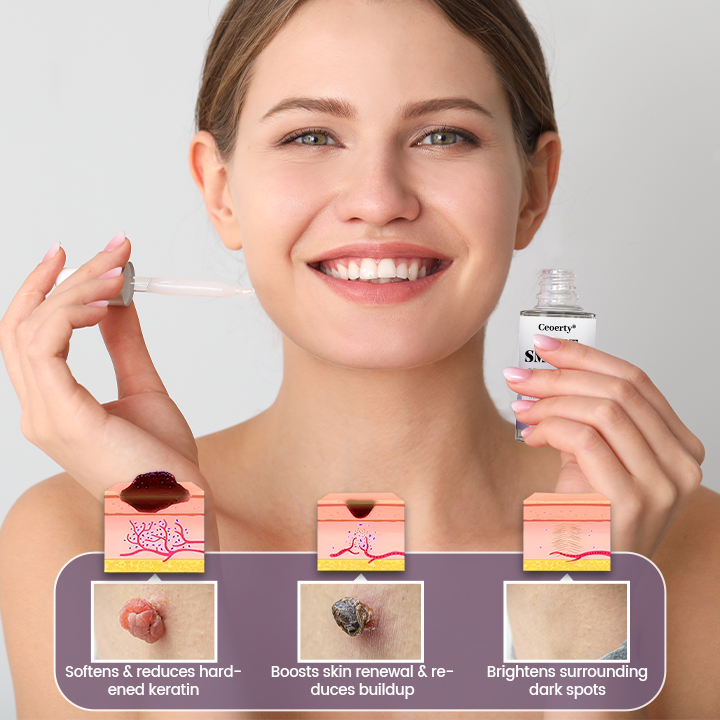 Ceoerty® WartSmooth Renewal Serum