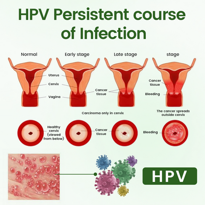 Timilk® FeminaDefend All-In-One Intimate Therapy Pads