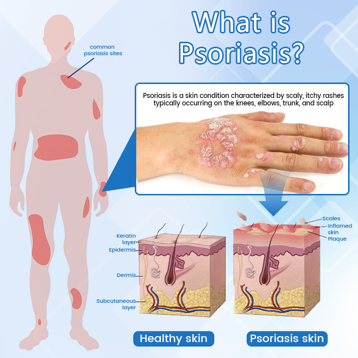 ✅ Official Store: Timilk® DermaMag Magnesium Repair Spray 🔥 FDA Certified (Clinically Proven Relief for Psoriasis, Eczema, and Chronic Skin Irritation 🌿)