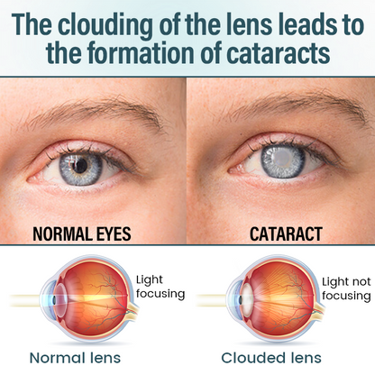 ✅ Official Store: Timilk® OptiFusion Nano Eye Drops Serum 🔥 FDA Certified (Clinically Proven to Restore Vision for Cataracts, Presbyopia, Dry Eyes & More 👁️) 🩺