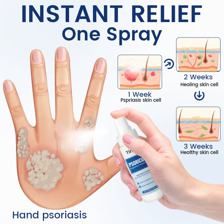 Timilk® PsoriCure Magnesium Herbal Spray