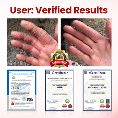 Timilk® VitaGluco Diabetic Care Cream