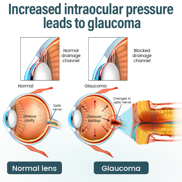 ✅ Official Store: Timilk® OptiFusion Nano Eye Drops Serum 🔥 FDA Certified (Clinically Proven to Restore Vision for Cataracts, Presbyopia, Dry Eyes & More 👁️) 🩺