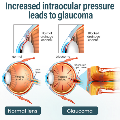 ✅ Official Store: Timilk® OptiFusion Nano Eye Drops Serum 🔥 FDA Certified (Clinically Proven to Restore Vision for Cataracts, Presbyopia, Dry Eyes & More 👁️) 🩺