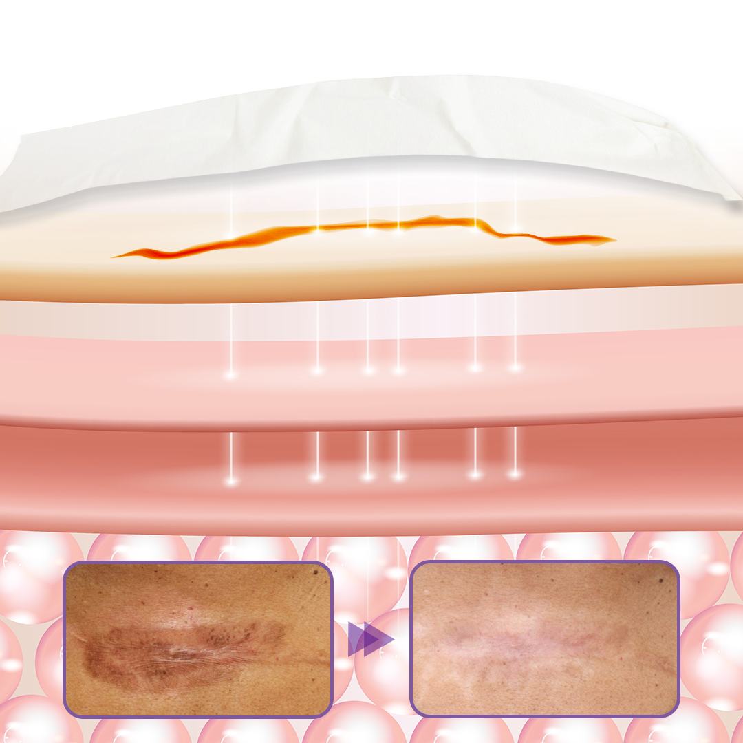 Timilk® HyaRepair Microneedle Skin Tape