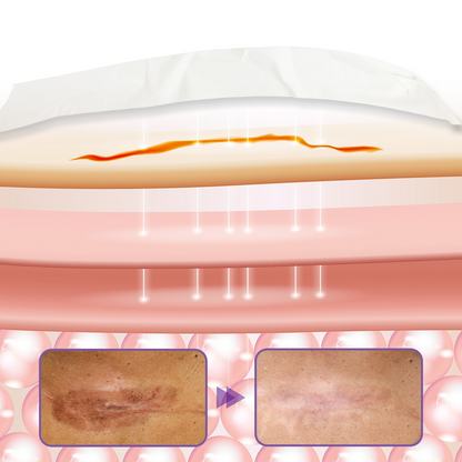 Timilk® HyaRepair Microneedle Skin Tape