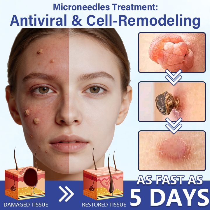 🔥Timilk® DermalRepair 2-in-1 Microneedle & Hydrocolloid Patch 💉| Raised Moles, Acne, Flat Warts & Skin Tags Remover | Improves Wrinkles, Scars & Blemishes | Invisible Pimple Patches for Face & Body💎