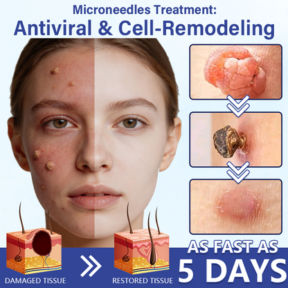 🔥Timilk® DermalRepair 2-in-1 Microneedle & Hydrocolloid Patch 💉| Raised Moles, Acne, Flat Warts & Skin Tags Remover | Improves Wrinkles, Scars & Blemishes | Invisible Pimple Patches for Face & Body💎