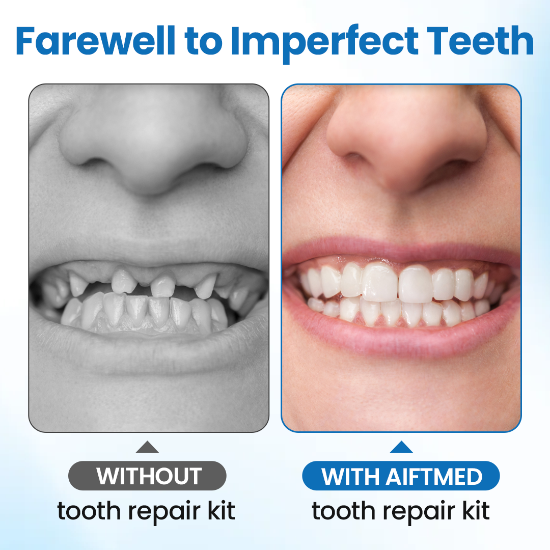Timilk® SmileMend Tooth Repair Filling Kit