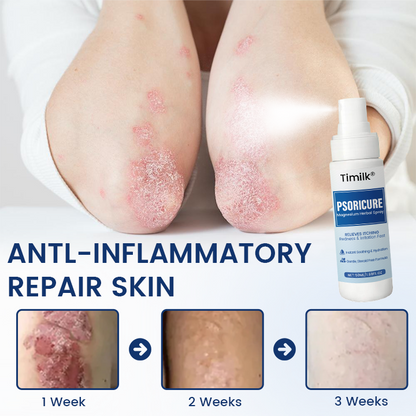Timilk® PsoriCure Magnesium Herbal Spray
