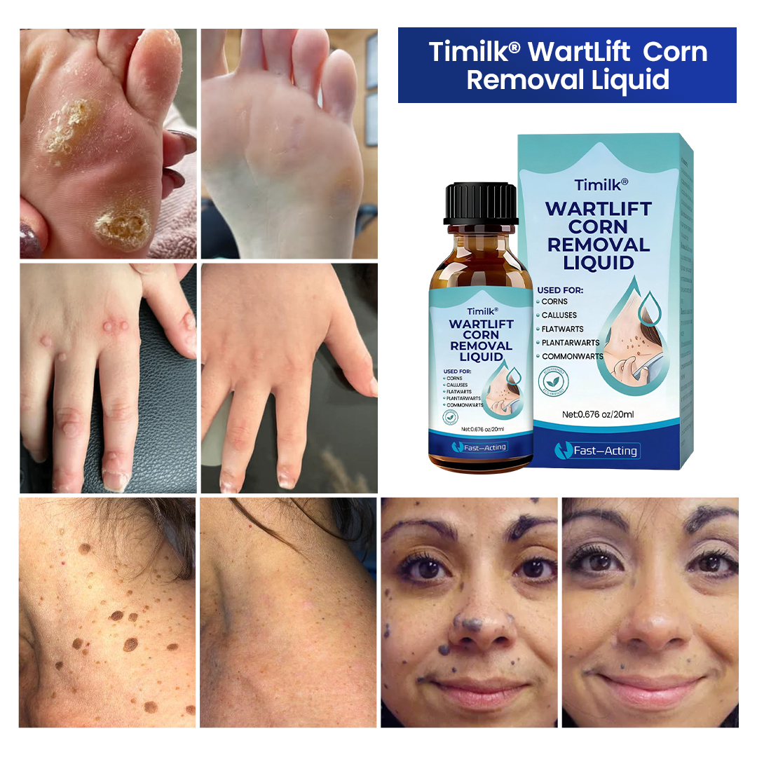 Timilk® WartLift Corn Removal Liquid 💝