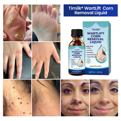 Timilk® WartLift Corn Removal Liquid 💝