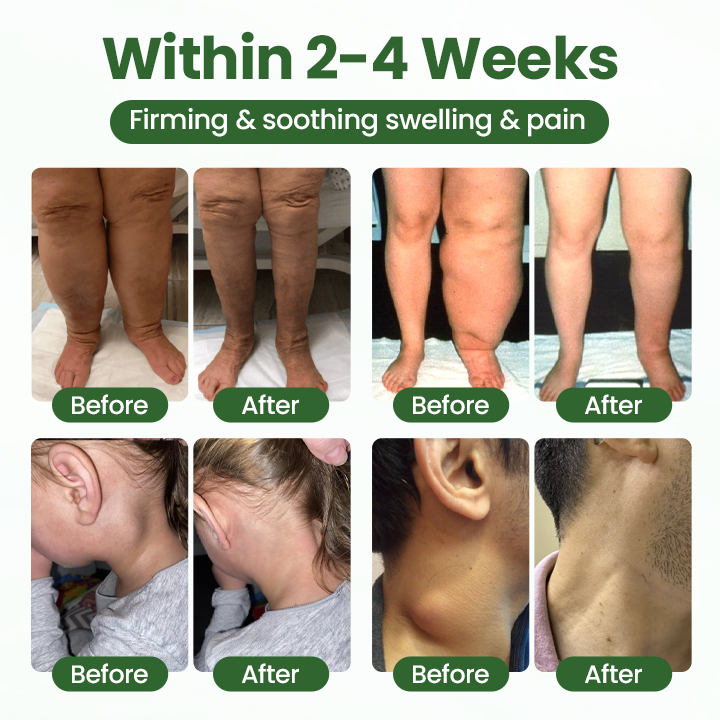 Timilk® BodyRelief Circulation Cream