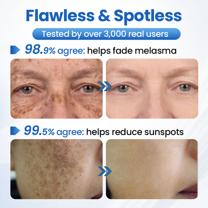 Biancat® GlowFade Brightening & Spot-Removing Mask