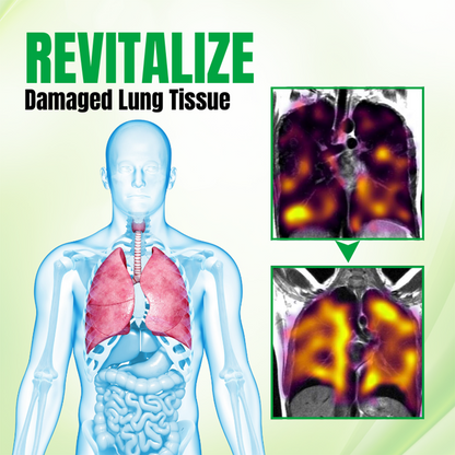 Biancat® RespiPure Herbal Lung Detox Spray